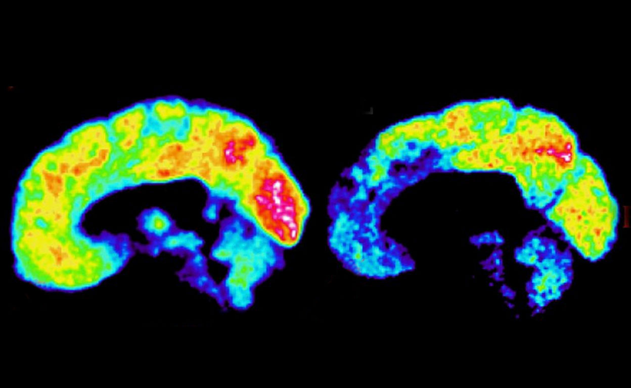 James Fallon El Neur Logo Con Cerebro De Psic Pata Xlsemanal